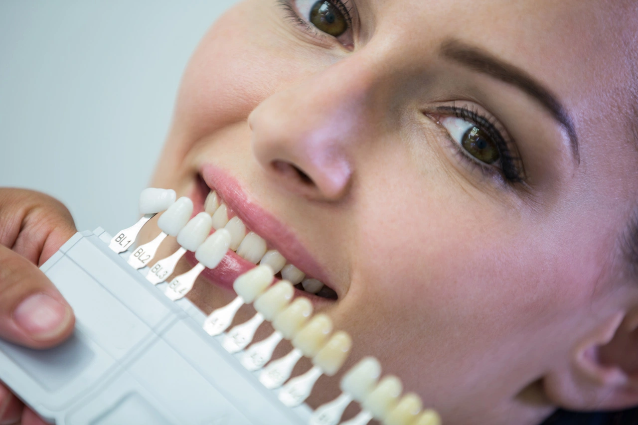 dentist-examining-female-patient-with-teeth-shades