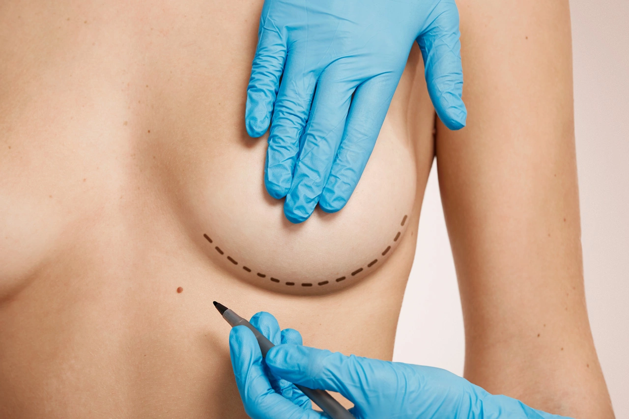 woman-marked-out-cosmetic-surgery